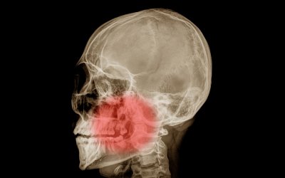 TMJ/Facial Pain Parkway Clinic TMJ/Facial Pain Parkway Clinic