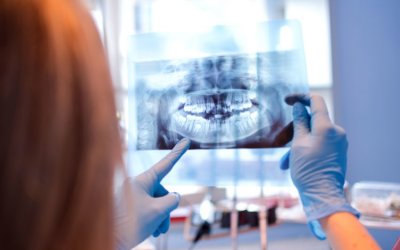 Full Mouth Reconstruction Parkway Clinic Full Mouth Reconstruction Parkway Clinic