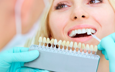 Veneers Parkway Clinic Veneers Parkway Clinic