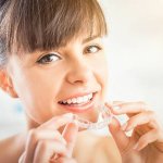 Invisalign Lite Invisalign Lite