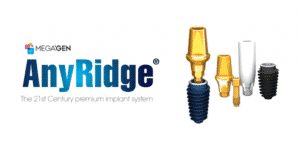 Implant-dentar-premium-megagen-anyridge-1024×536